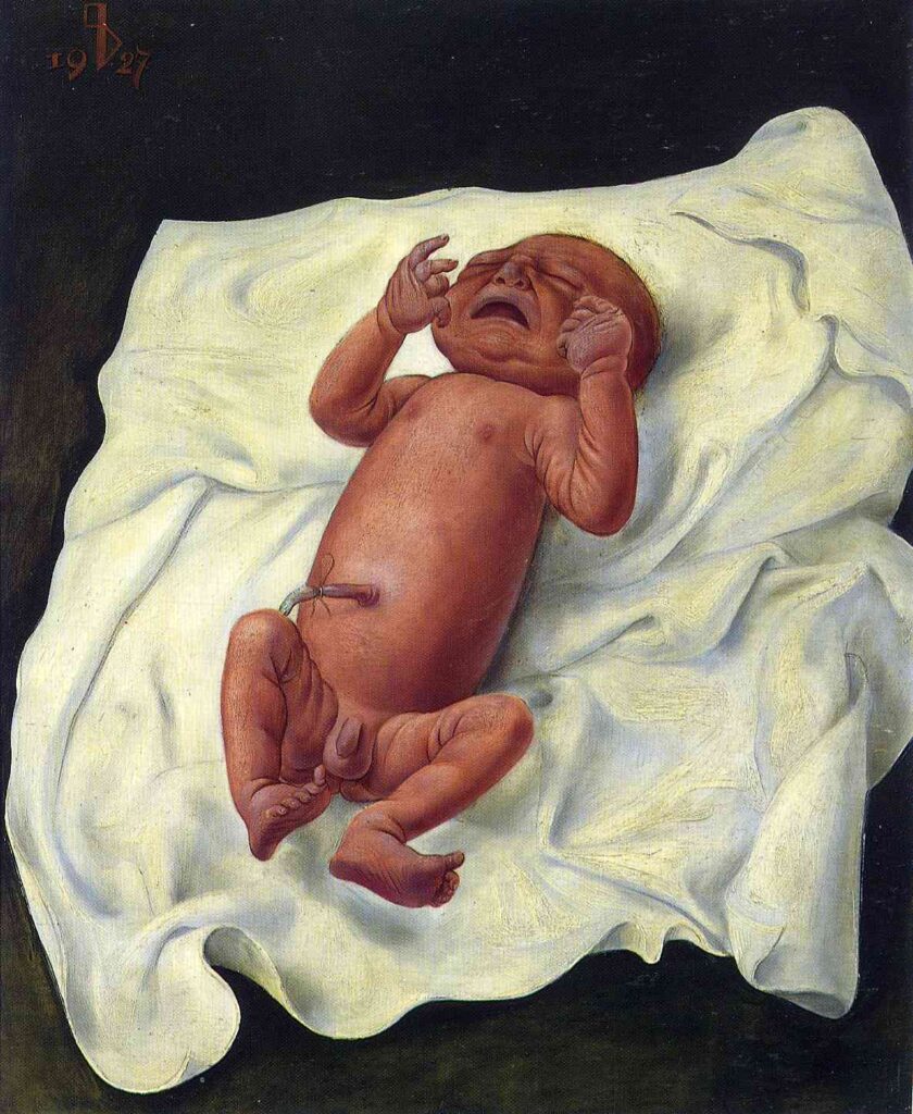 Baby With Umbilical Cord (1934) - Otto Dix Tablo