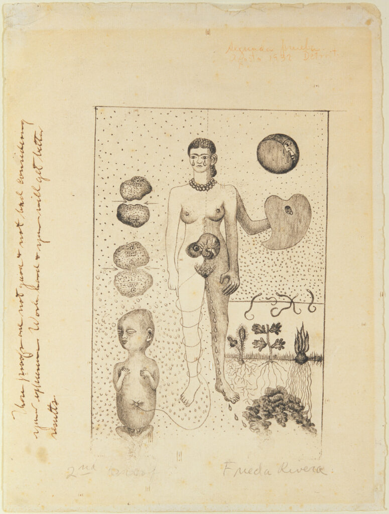 Frida and the Miscarriage (1932) – Frida Kahlo Tablo