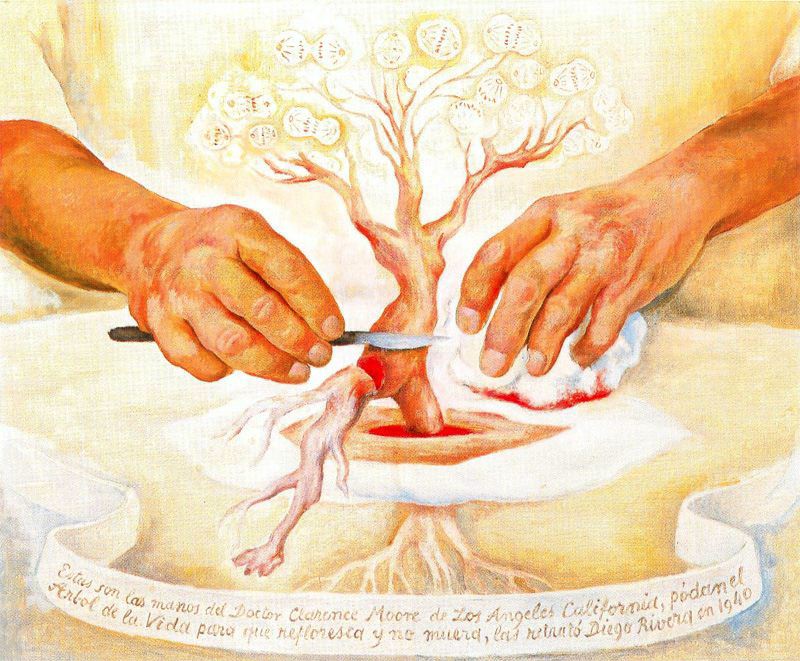 The Hands of Dr Moore (1940) – Diego Rivera Tablo